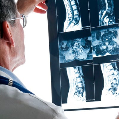 Herniated Disks & Spinal Injuries After A Car Accident in Arizona